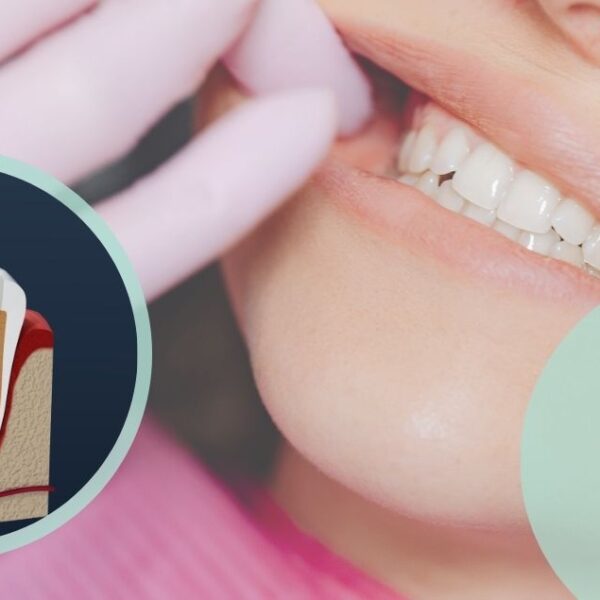 Endodonzia ODONTOIATRICA CREMONESE
