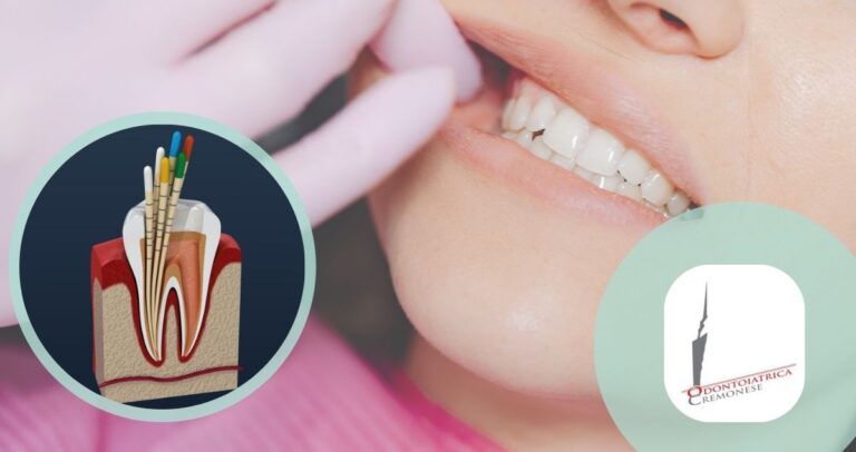 Endodonzia ODONTOIATRICA CREMONESE
