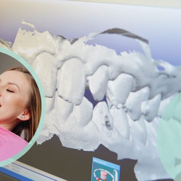 Impronta dentale digitale ODONTOIATRICA CREMONESE