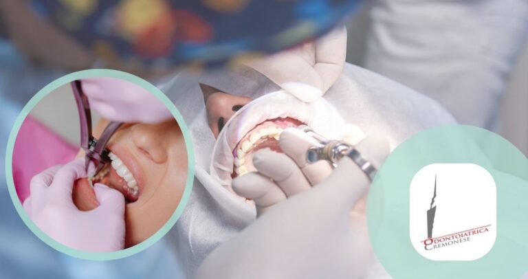 chirurgia dentale ODONTOIATRICA CREMONESE