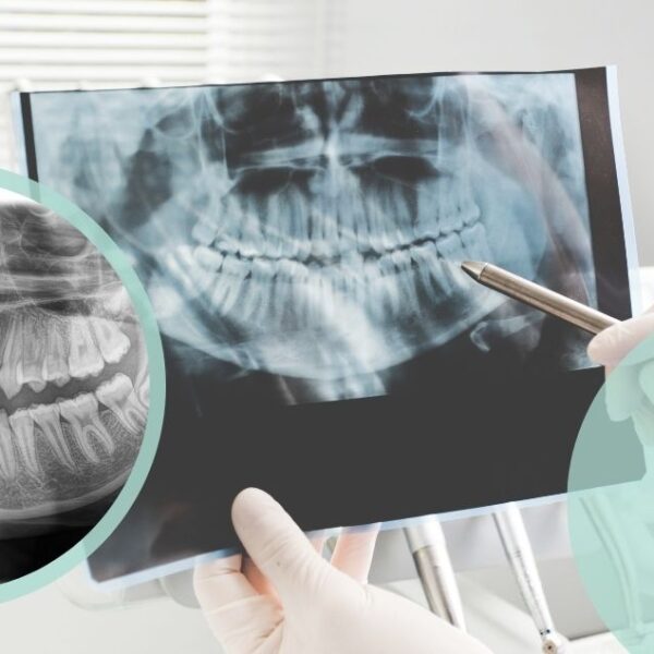 ortopantomografia dentale ODONTOIATRICA CREMONESE