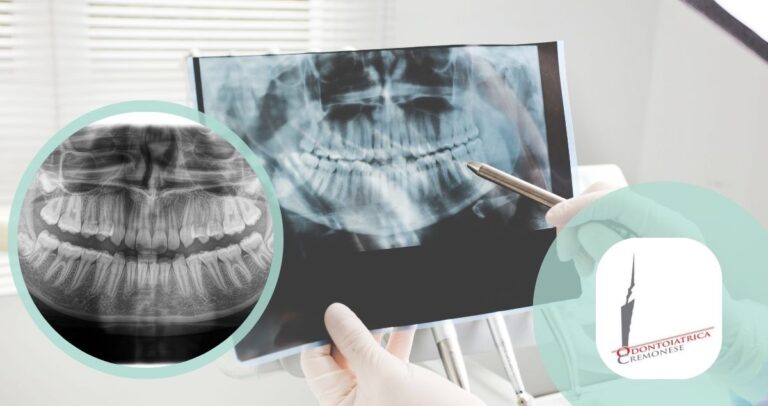 ortopantomografia dentale ODONTOIATRICA CREMONESE